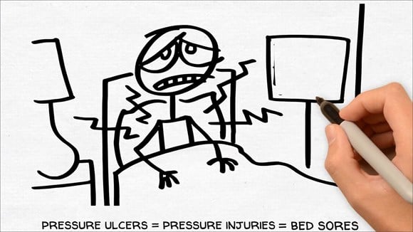 pressure ulcer cartoon